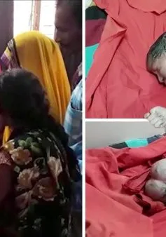 Bé gái sơ sinh... “ba đầu” tại Ấn Độ