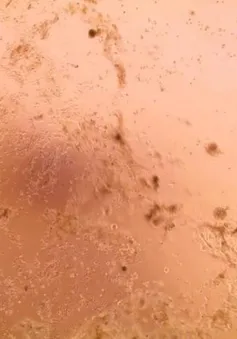 Châu Âu lần đầu nuôi cấy thành công chủng virus corona mới