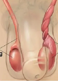 Đau tinh hoàn nhưng không viện điều trị, thiếu niên ở Quảng Ninh phải cắt tinh hoàn