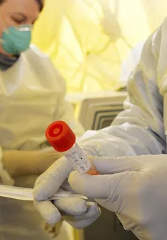 FDA cho phép xét nghiệm nước bọt để chẩn đoán COVID-19