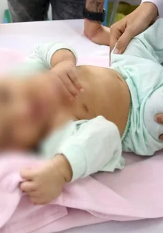 Phát hiện, điều trị kịp thời trẻ sơ sinh bị suy giáp bẩm sinh