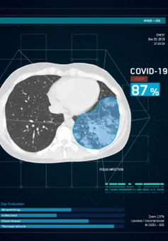 Trung Quốc sử dụng AI để dự báo nguy cơ bệnh nhân COVID-19 trở nặng