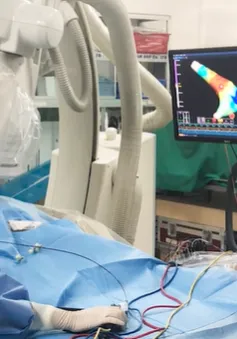 Thoát khỏi nỗi ám ảnh ngất xỉu nhờ phương pháp triệt đốt điện sinh lý