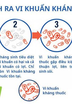 KENU MHcare - Bước tiến đột phá hỗ trợ điều trị viêm mũi dị ứng, viêm xoang, viêm amidan