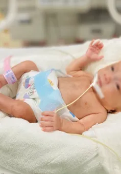 Sau 10 năm nghiên cứu, trau dồi, các bác sĩ Bệnh viện Phụ sản Trung ương lập kỳ tích cứu sống bé sinh non nặng vỏn vẹn 400 gram