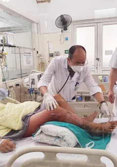 Hoại tử chân, nhiễm khuẩn huyết do nhiễm vi khuẩn Vibrio vulnificus