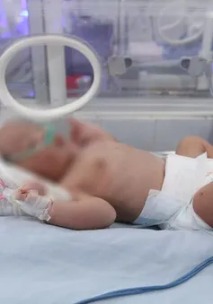 Cấp cứu bé sơ sinh mắc dị tật bẩm sinh bị bỏ rơi trong trời giá rét