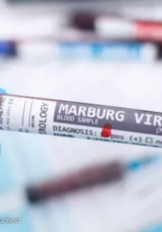 WHO họp khẩn vì ổ dịch sốt xuất huyết do virus Marburg