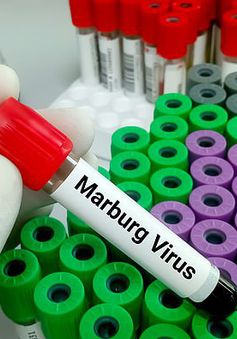 Bùng phát virus Marburg gây tử vong cao ở Tanzania