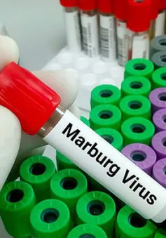 Những điều cần biết về bệnh do virus Marburg