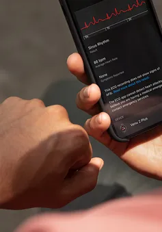 Ứng dụng Điện tâm đồ ECG được tích hợp trên đồng hồ Garmin