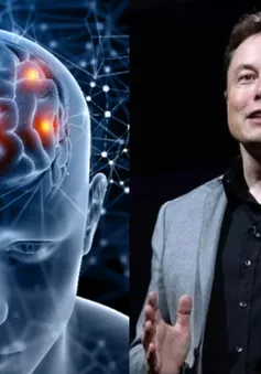 Triển vọng thử nghiệm cấy chip của công ty Neuralink