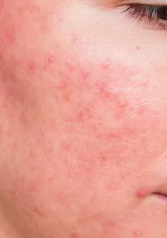 10 tình trạng về da phổ biến nhất bạn cần biết