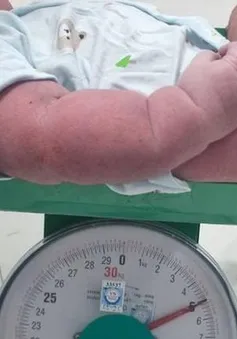 Hy hữu: Sản phụ đẻ thường lần thứ 6, hạ sinh bé trai nặng 5kg