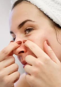 Đây là vùng da trên mặt có thể dẫn đến tử vong khi bạn nặn mụn