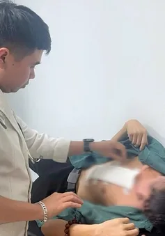 Phẫu thuật bóc u quái khổng lồ ra khỏi lồng ngực nam bệnh nhân
