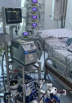 Can thiệp ECMO cứu bé gái mắc cúm A/H1 nặng