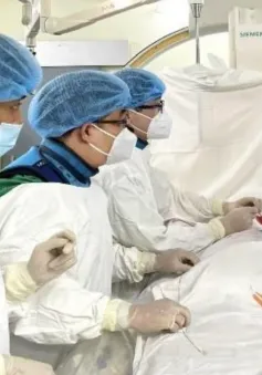Đột quỵ sau khi giác hơi