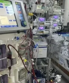 Can thiệp ECMO cứu bé gái sốc nhiễm trùng, suy đa cơ quan nặng