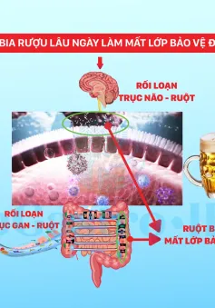 Cải thiện triệu chứng hội chứng ruột kích thích, bệnh tiêu hóa khi uống bia rượu