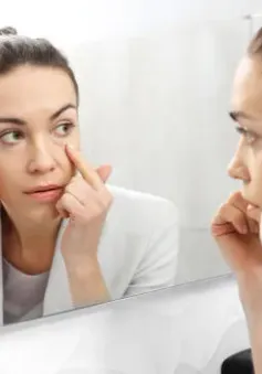 Cách loại bỏ quầng thâm mắt theo lời khuyên của bác sĩ da liễu