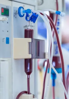 Biến chứng tim mạch trong lọc máu: Thách thức trong chẩn đoán và điều trị