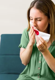 Hai dấu hiệu của bệnh huyết áp cao có thể nhận diện trên khuôn mặt