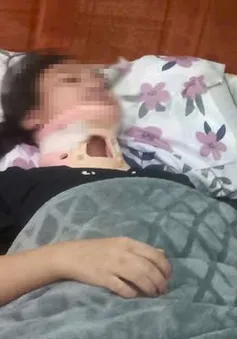 Khởi tố 6 nữ sinh đánh bạn gãy đốt sống cổ