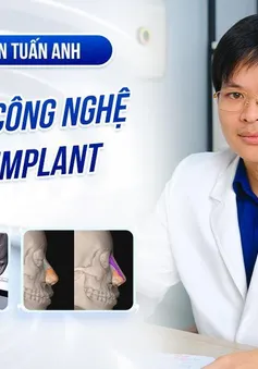 Bác sĩ thẩm mỹ Nguyễn Tuấn Anh giải đáp thắc mắc về công nghệ Nâng mũi In 3D Implant