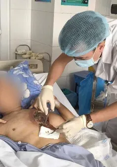 Mắc nấm hiếm gặp, người đàn ông hoại tử mô cơ vùng ngực trái