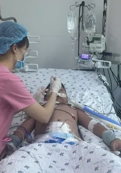 Bé trai sốc sốt xuất huyết nặng biến chứng suy hô hấp, rối loạn đông máu