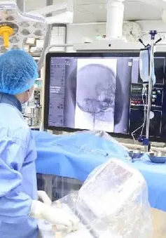 Cảnh báo gia tăng số ca đột quỵ ở người trẻ