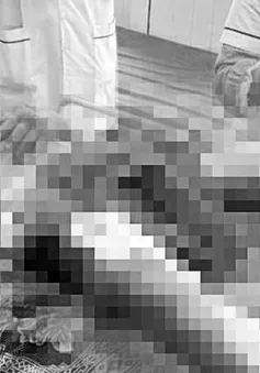 Người đàn ông bị bỏng nặng vùng kín nghi do sạc dự phòng phát nổ