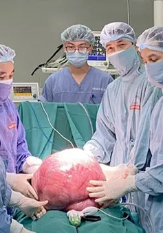 Phẫu thuật cắt khối u khổng lồ nặng 15kg trong bụng người phụ nữ
