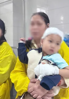 Bỏng nước sôi ở trẻ em - bất cẩn từ người lớn dẫn đến hậu quả khó lường