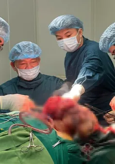 Quảng Bình: Phẫu thuật thành công khối u dị dạng mạch máu hiếm gặp vùng mặt