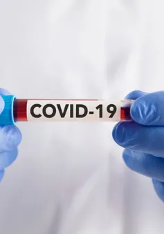 Hơn 25 nghìn ca nhiễm COVID-19 trên thế giới trong vòng gần một tháng, Bộ Y tế khuyến cáo chủ động phòng ngừa