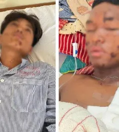 Nổ mìn tự chế khi đi đánh cá, hai thiếu niên bị thương nặng