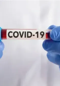 Diễn biến COVID-19 tại TP Hồ Chí Minh