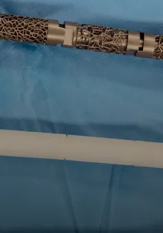 Thay xương đùi nhân tạo bằng công nghệ 3D