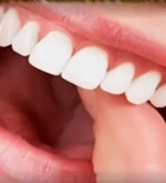 8 lưu ý trong chăm sóc răng miệng