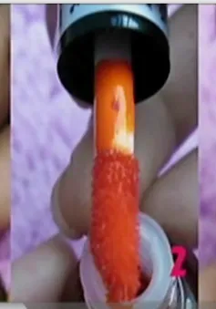 Hỏng hệ tiêu hóa vì son nước kém chất lượng