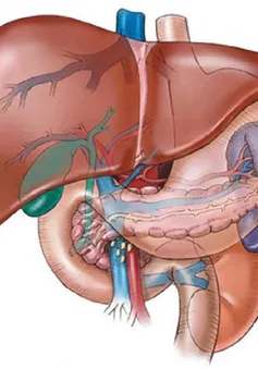 Bệnh gan nhiễm mỡ và những lưu ý cần thiết