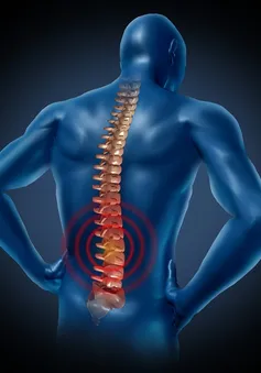 Kết hợp nhiều phương pháp trong điều trị bệnh lý cột sống 