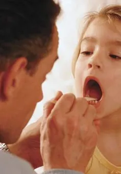 Chăm sóc trẻ sau nạo V.A và cắt Amiđan