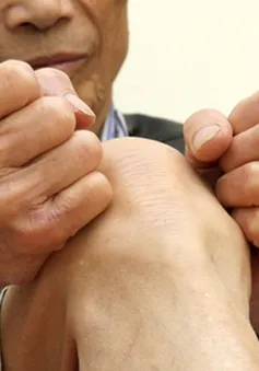Người già dễ mắc bệnh thoái hóa khớp