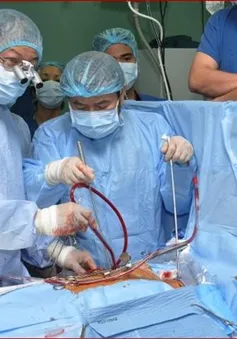 Lần đầu tiên đưa nội soi thay van tim vào thường quy