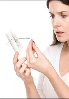 Bệnh lý rụng tóc: Nỗi ám ảnh do đâu?
