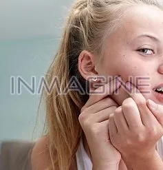 Giải pháp tránh mụn trứng cá