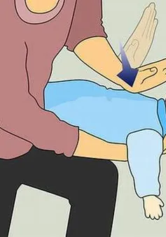 Bé bị hóc thạch - Làm sao đây?